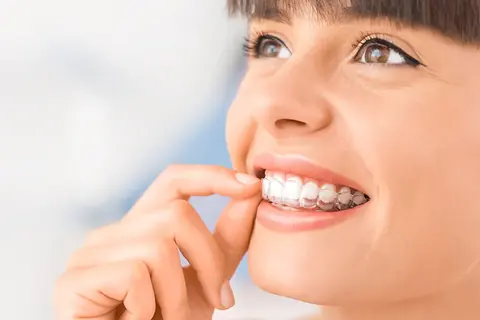 Clear Aligners in Arvada, CO